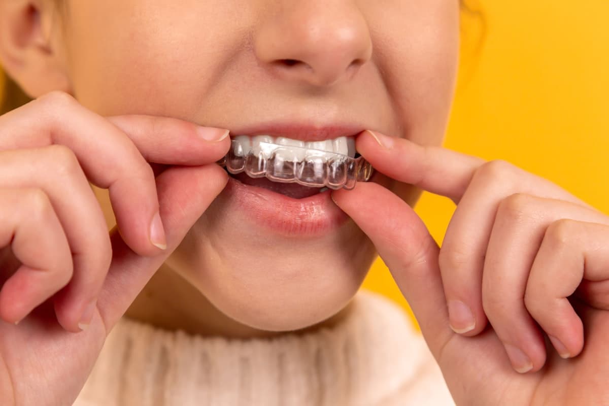 Dental implant smile restoration consultation